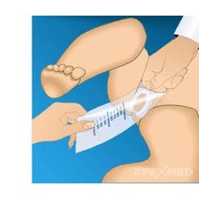 Ουροσυλλέκτης Παιδικός - 