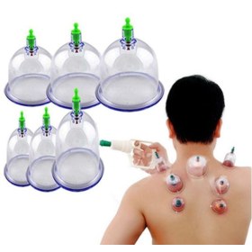 Βεντούζες για παραδοσιακή θεραπεία - Σετ 18 τμχ