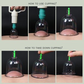 Συσκευή θεραπευτικής αγωγής με βεντούζες 6 τμχ, 19075 - 