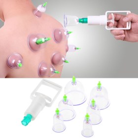 Συσκευή θεραπευτικής αγωγής με βεντούζες 6 τμχ, 19075