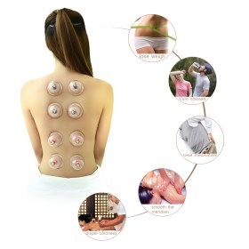 Συσκευή θεραπευτικής αγωγής με βεντούζες 6 τμχ, 19075 - 